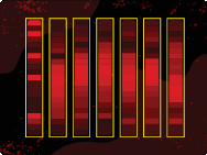 Lanes found on a Western blot by the Empiria Studio adaptive lane finding algorithm